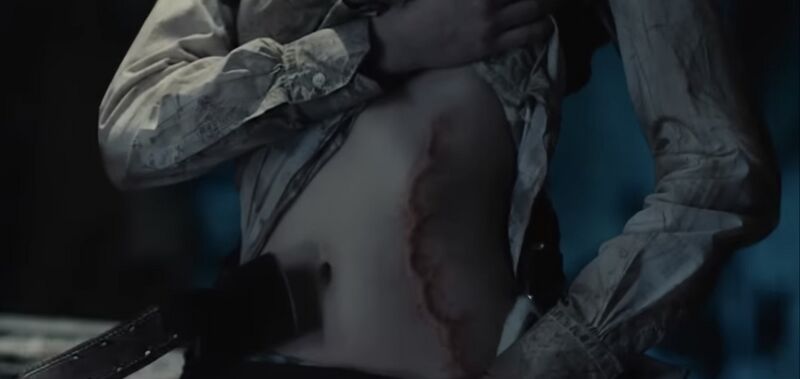 File:Mikasa's bitemark scar.jpeg