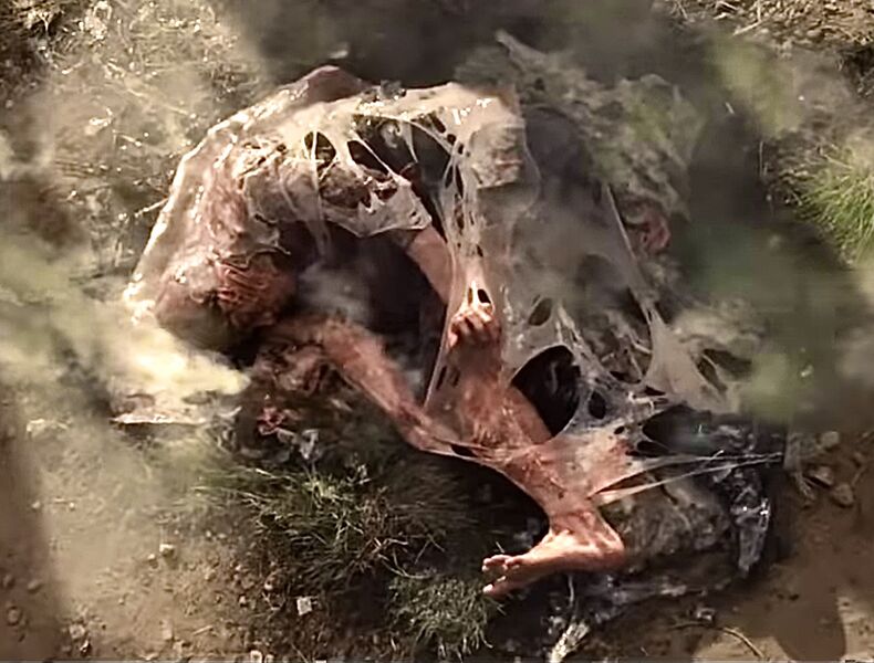 File:RegeneratedLeg.jpeg